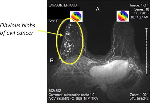 MRI-annotated